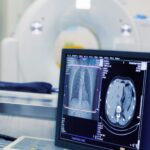 screening tests and imaging