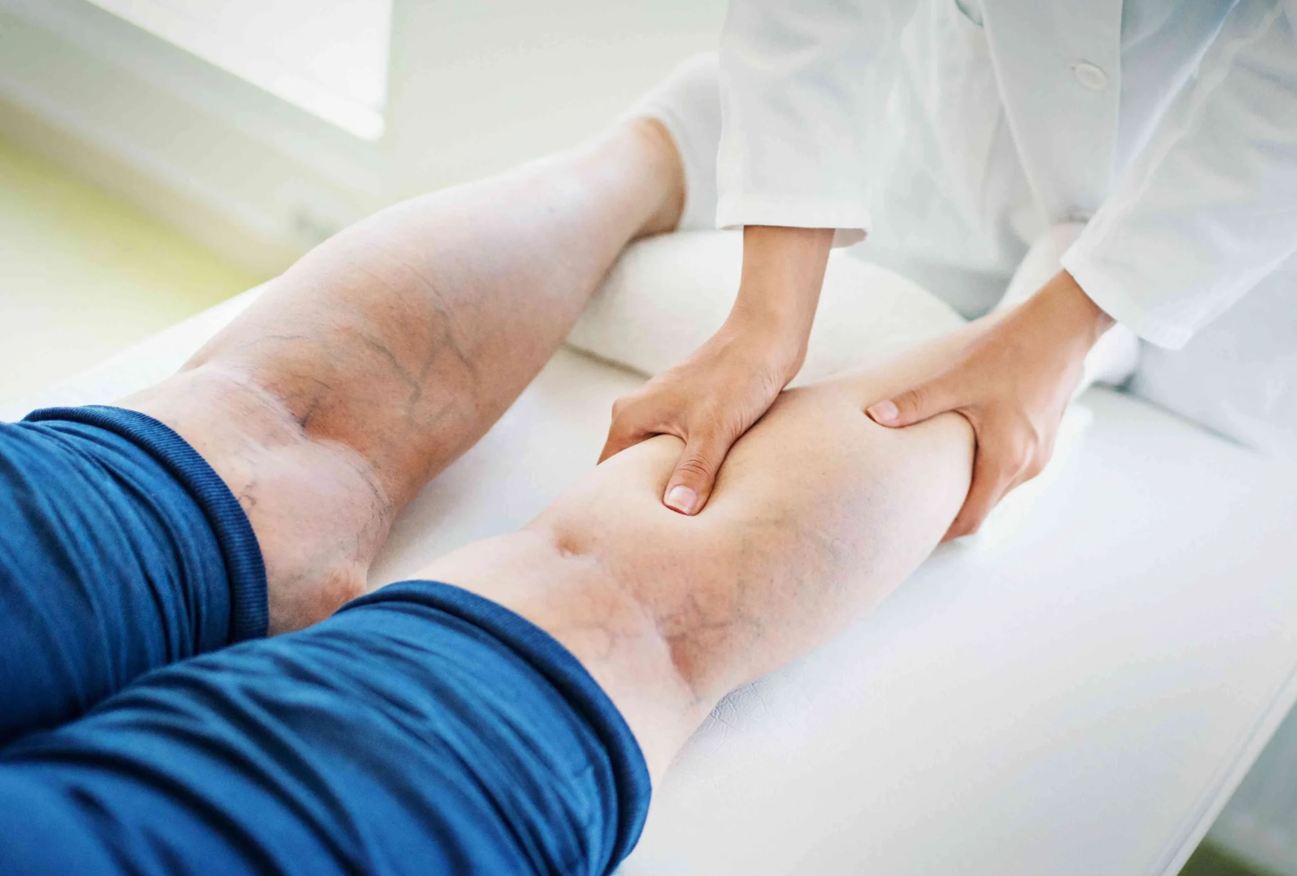 Vein Treatments in Brooklyn, New York: Advanced Solutions for Varicose and Spider Veins